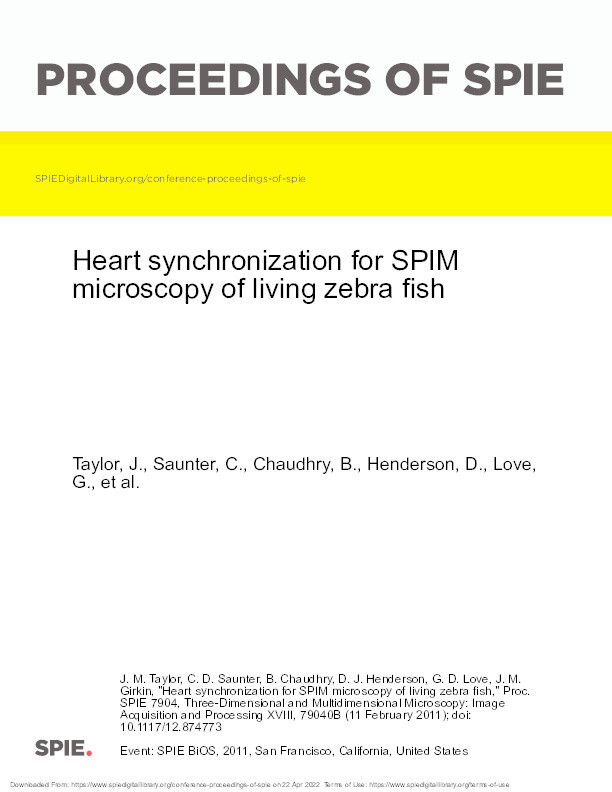 Heart synchronization for SPIM microscopy of living zebra fish Thumbnail