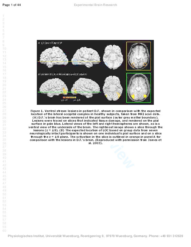 Intact automatic avoidance of obstacles in patients with visual form agnosia Thumbnail